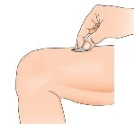 Una mano applica un piccolo cerotto o un dispositivo medico sulla pelle della parte superiore di un ginocchio piegato