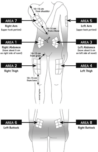 Diagramma del corpo umano con otto aree numerate per iniezioni su braccia, addome, cosce e glutei con indicazioni sulle distanze in centimetri
