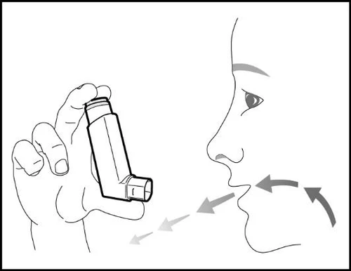 Disegno schematico di una mano che tiene un inalatore vicino alla bocca di un profilo umano con frecce che indicano il flusso d'aria