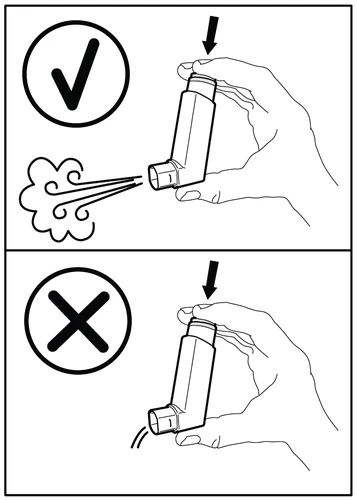 Disegno tecnico che mostra una mano che preme correttamente l'inalatore verso il basso con spray emesso e una mano che lo preme in modo errato