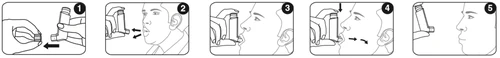 Sequence of five drawings illustrating the