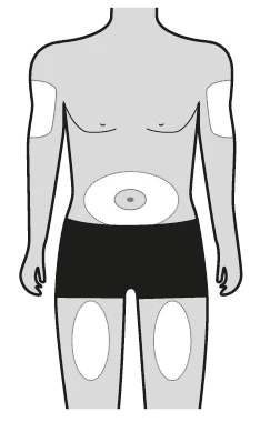 Diagram of a male human body indicating injection sites on the skin