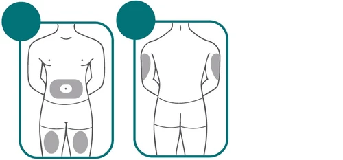 Schematic diagrams of a human body showing gray application areas on the