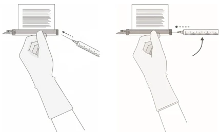 Illustrazione medica che mostra una mano guantata che tiene una penna iniettore mentre una siringa viene inserita lateralmente con una freccia tratteggiata