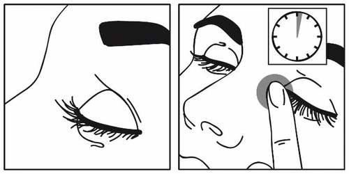 Black and white drawing of a face with closed eyes and a hand gently pressing on the eyelid near a clock indicating time