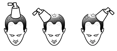 Three schematic drawings show a device applied to the top of a man's head at three different tilt angles