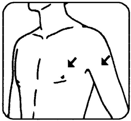 Schematic drawing of a man's torso with two black arrows indicating injection sites on the chest and upper arm