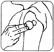 Black and white drawing of a hand holding a syringe to prepare an injection