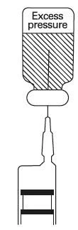 Technical diagram of a syringe showing excessive pressure indicated by diagonal hatching in the upper part of the container