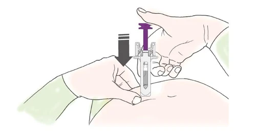 Due mani impugnano un dispositivo medico per iniettare un farmaco nella parte superiore dell'addome con una freccia nera verso il basso