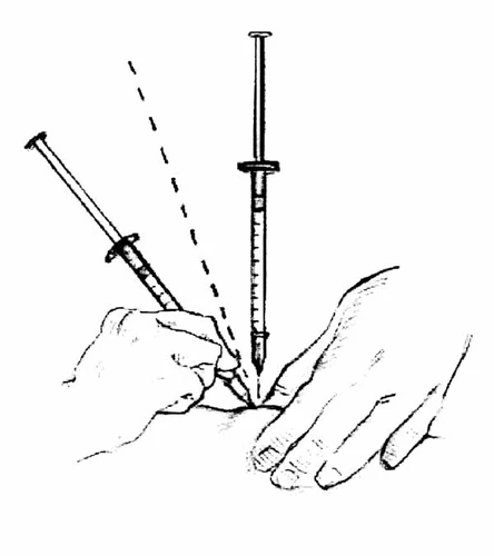 Technical drawing showing two different angles for the