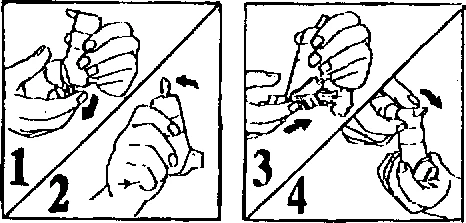 Dibujo técnico en cuatro pasos que muestra las manos manipulando un dispositivo médico para la preparación y la