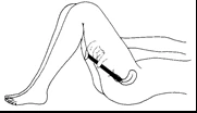 Disegno lineare di una gamba piegata con una siringa che inserisce l'ago nel muscolo della coscia per un'iniezione intramuscolare