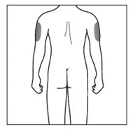 Disegno schematico del corpo umano visto di schiena con aree grigie evidenziate sulla parte superiore esterna di entrambe le braccia