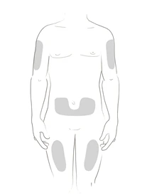 Schema del corpo umano maschile con aree grigie che indicano i siti di applicazione del farmaco sulle braccia, sull'addome e sulle cosce