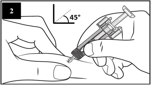 Disegno tecnico che mostra una mano che inserisce un dispositivo medico nella pelle con un angolo di 45 gradi indicato da un diagramma
