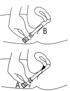 Two-step technical drawing showing a hand gripping a medical device for