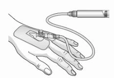 Technical drawing of a hand holding a medical device connected to a flexible tube and an upper cylindrical container