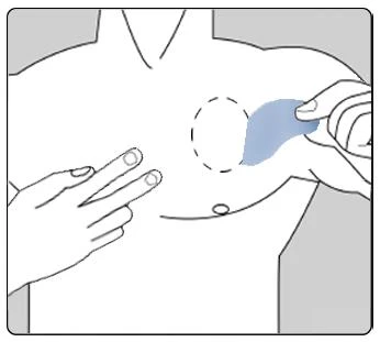 Disegno schematico del torace di un uomo con una mano che indica un punto e l'altra che applica un cerotto sulla pelle sopra il seno