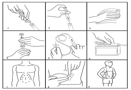 Serie di nove illustrazioni che mostrano le fasi di preparazione e somministrazione di un farmaco tramite siringa e dispositivo medico sul corpo