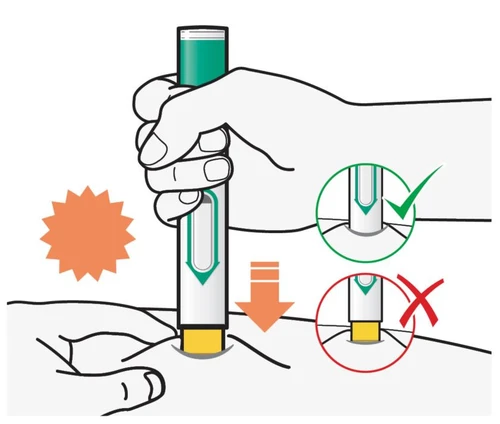 Medical illustration showing the