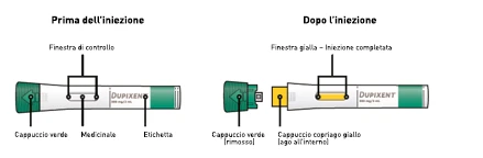 Diagram showing a medical device before and after the