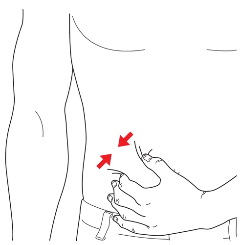 Line drawing of a human torso with a hand pinching the skin