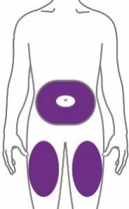 Schematic of the human body with three purple areas indicating application sites on the body