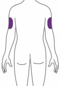 Schematic drawing of a human body viewed from the back with two rectangular purple areas positioned on the upper part of both arms