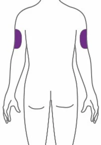 Stylized drawing of the torso and arms of a person viewed from the back, with two purple spots on the upper part of both arms