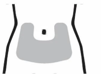 Diagramma stilizzato di un torso umano con un'area grigia a forma di U che indica la zona addominale per l'applicazione del farmaco