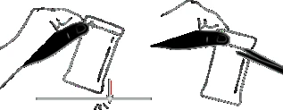 Schematic drawing showing two hands gripping a medical device for
