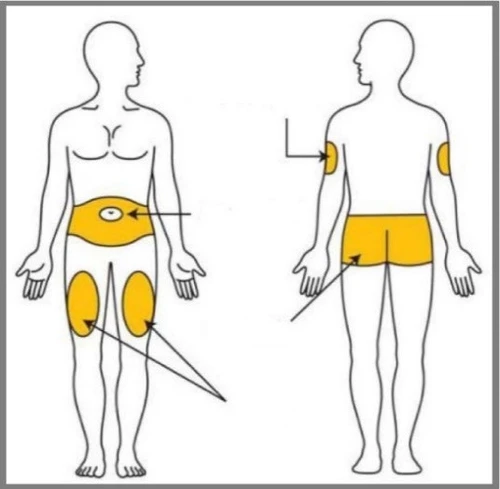 Diagram of two human figures indicating yellow application areas on the