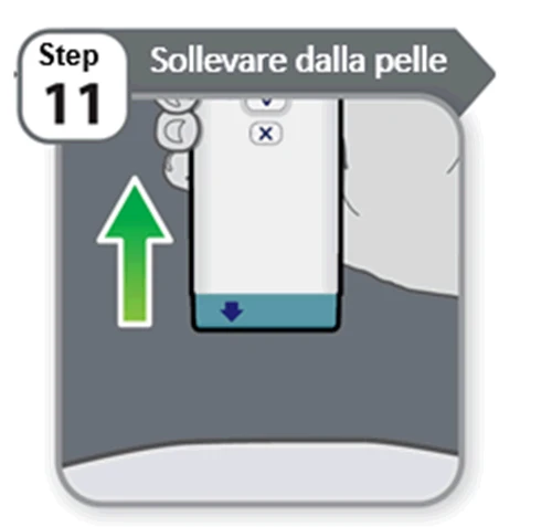 Illustrazione del passaggio 11 con testo Sollevare dalla pelle e una freccia verde rivolta verso l'alto accanto a un dispositivo medico bianco