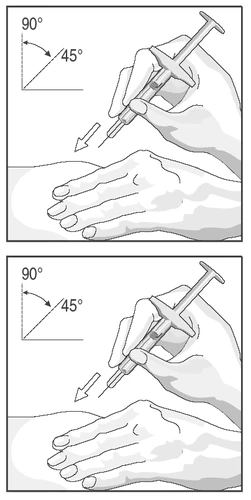 Disegno tecnico che mostra una mano che impugna una siringa per iniettare un farmaco nel braccio con un angolo compreso tra 45 e 90 gradi