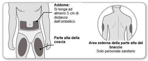 Diagramma medico che indica le zone di iniezione sull'addome lontano dall'ombelico, sulla parte alta della coscia e sull'area esterna del braccio