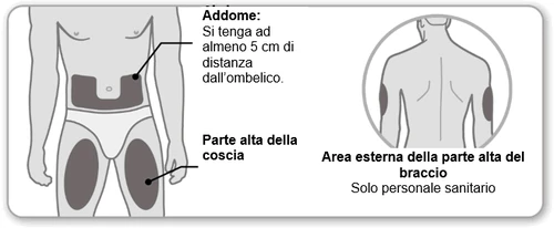 Diagramma medico che mostra le zone di iniezione sull'addome lontano dall'ombelico, sulla parte alta della coscia e sull'area esterna del braccio