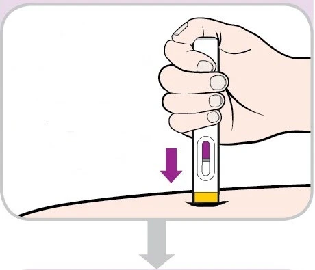 Una mano impugna un dispositivo medico a penna e lo preme verso il basso sulla pelle del braccio seguendo la direzione di una freccia viola
