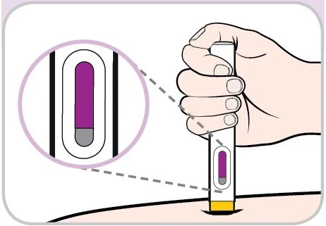 Una mano impugna un dispositivo medico cilindrico sopra la pelle con un ingrandimento che mostra il livello di un liquido viola interno