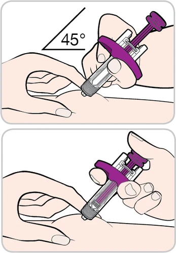 Due illustrazioni mostrano mani che impugnano un iniettore con punta viola per somministrare un farmaco con un angolo di 45 gradi
