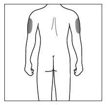 Schematic drawing of the back of a human body with two gray highlighted areas on the outer upper parts of both arms