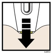 Diagram showing a white medical device with a black downward arrow indicating pressure movement onto the skin