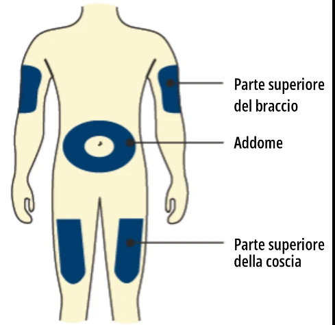 Diagramma del corpo umano che indica le zone di applicazione: parte superiore del braccio, addome e parte superiore della coscia