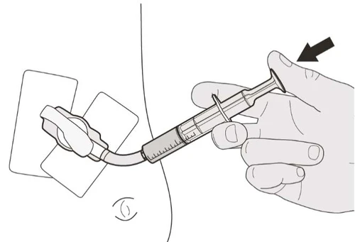 A hand holds a syringe with a needle being inserted through an application device onto a flat white surface