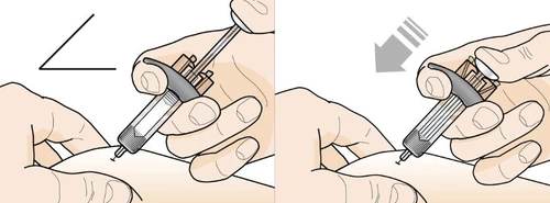 Medical illustration showing two hands holding a syringe for administration