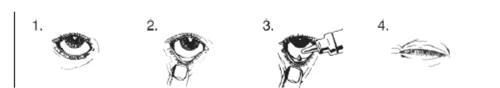 Sequenza di quattro disegni che mostrano l'applicazione di un collirio con l'occhio aperto, l'inserimento del flacone e l'occhio chiuso