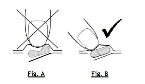 Diagrama médico con dos ilustraciones que muestran la correcta colocación de una cápsula sobre la lengua, con una equis en la Fig. A y una marca de verificación en la Fig. B