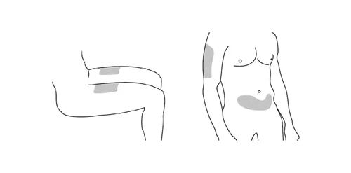 Schematic drawing of a human body showing drug administration sites on the thigh and on the
