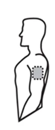 Schematic drawing of a man's profile showing a gray circle applied to the upper right arm