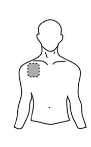 Line drawing of a male torso with a dashed gray circle positioned on the upper right arm for